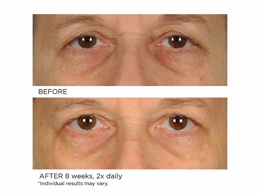 NassifMD® Anti-Aging Under Eye Smoother 5 NassifMD® Anti-Aging Under Eye Smoother - Image 3