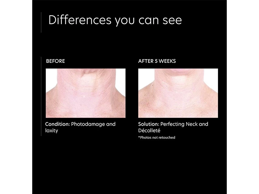 PCA SKIN Perfecting Neck And Decollete 7 PCA SKIN Perfecting Neck And Decollete - Image 5