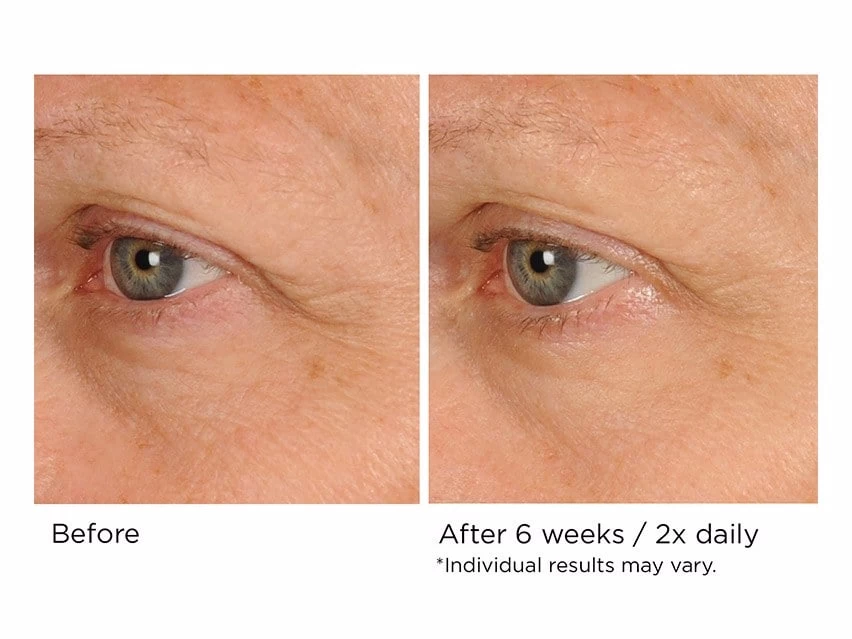 NassifMD® Peri-Orbital Complex Revitalizing Eye Cremè 4 NassifMD® Peri-Orbital Complex Revitalizing Eye Cremè - Image 2