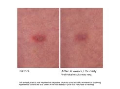 NassifMD® Eczema Soothing Skin Cream 11 NassifMD® Eczema Soothing Skin Cream -Care Products Store por3pcxt 202103051356087966