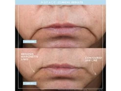 NuFACE MINI+ Supercharged Skincare Routine - Limited Edition -Care Products Store pri4avf3 202305301615570783