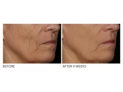 Dr. Dennis Gross Skincare DRx SpectraLite™ FaceWare Pro -Care Products Store qpvnrvcm 202012152003471277