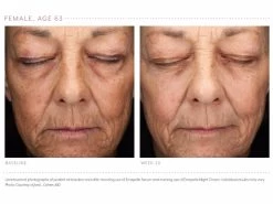 Emepelle Night Cream 19 Emepelle Night Cream -Care Products Store rd0fmcek 202102161740393156