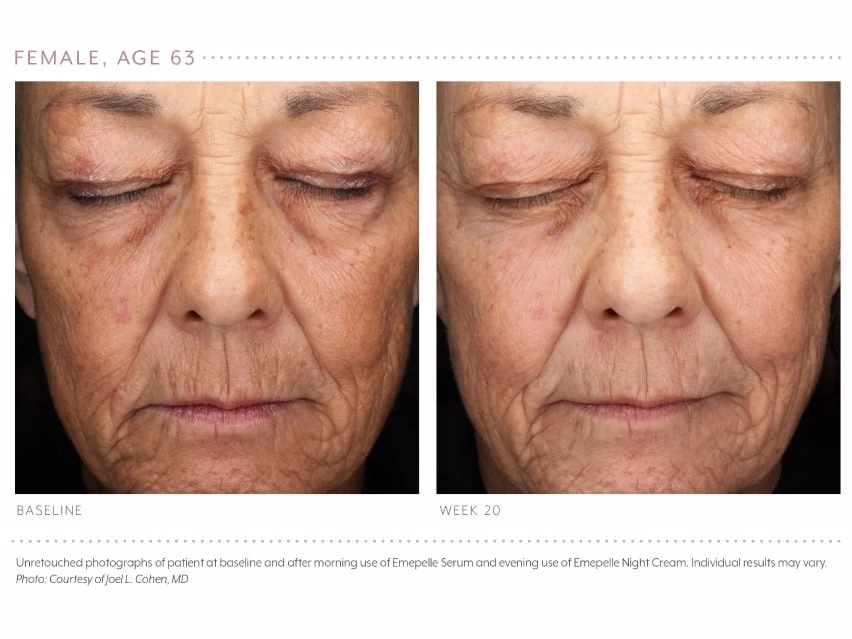 Emepelle Night Cream 10 Emepelle Night Cream - Image 8