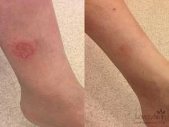 FixMySkin 1% Hydrocortisone Healing Body Balm – Fragrance-Free 8 FixMySkin 1% Hydrocortisone Healing Body Balm – Fragrance-Free -Care Products Store re2atg3h 202004281851343340