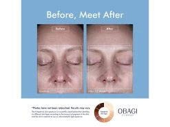 OBAGI Clinical® Dark Spot Disruptor Discoloration Correcting Serum 11 OBAGI Clinical® Dark Spot Disruptor Discoloration Correcting Serum -Care Products Store rhw1ydl3 202206231540129340