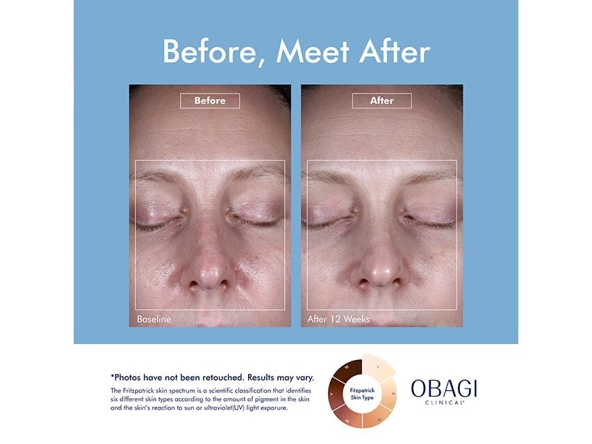 OBAGI Clinical® Dark Spot Disruptor Discoloration Correcting Serum 6 OBAGI Clinical® Dark Spot Disruptor Discoloration Correcting Serum - Image 4