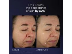 PCA SKIN Pro-Max Age Renewal Advanced Serum -Care Products Store rskvpajg 202305231702176924