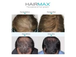 HairMax Flip 80 Laser Cap 9 HairMax Flip 80 Laser Cap -Care Products Store rua32stf 202102241649153074