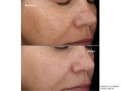 SkinMedica LYTERA 2.0 Pigment Correcting Serum -Care Products Store s2cgodgx 202012151923201035