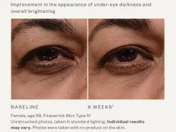 SkinMedica Instant Bright Eye Cream -Care Products Store s5p1bsxw 202002192344387999