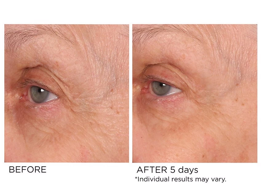 NassifMD® Age-Defying Eye Renewal Serum 9 NassifMD® Age-Defying Eye Renewal Serum - Image 7