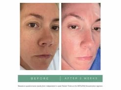 Replenix Brightening Eye Cream 7 Replenix Brightening Eye Cream -Care Products Store t0ssldgz 202208101822267847