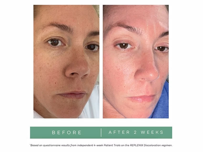 Replenix Brightening Eye Cream 5 Replenix Brightening Eye Cream - Image 3