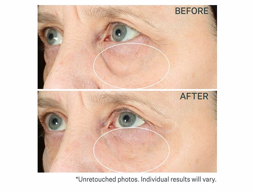 StriVectin Hyperlift Eye Instant Eye Fix 5 StriVectin Hyperlift Eye Instant Eye Fix - Image 3