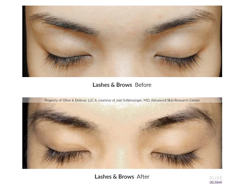 NeuLASH/neuBROW PROFESSIONAL™ By Skin Research Laboratories® Introductory Kit 10 NeuLASH/neuBROW PROFESSIONAL™ By Skin Research Laboratories® Introductory Kit - Image 8