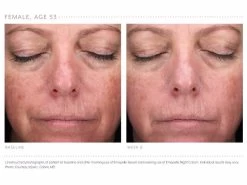 Emepelle Night Cream 16 Emepelle Night Cream -Care Products Store tiltwjrk 202102161641465861