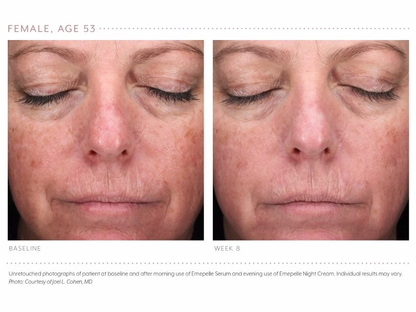 Emepelle Night Cream 7 Emepelle Night Cream - Image 5