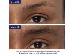 Obagi Nu-Cil™ Eyebrow Boosting Serum -Care Products Store tuh5rbfq 202208171949194865