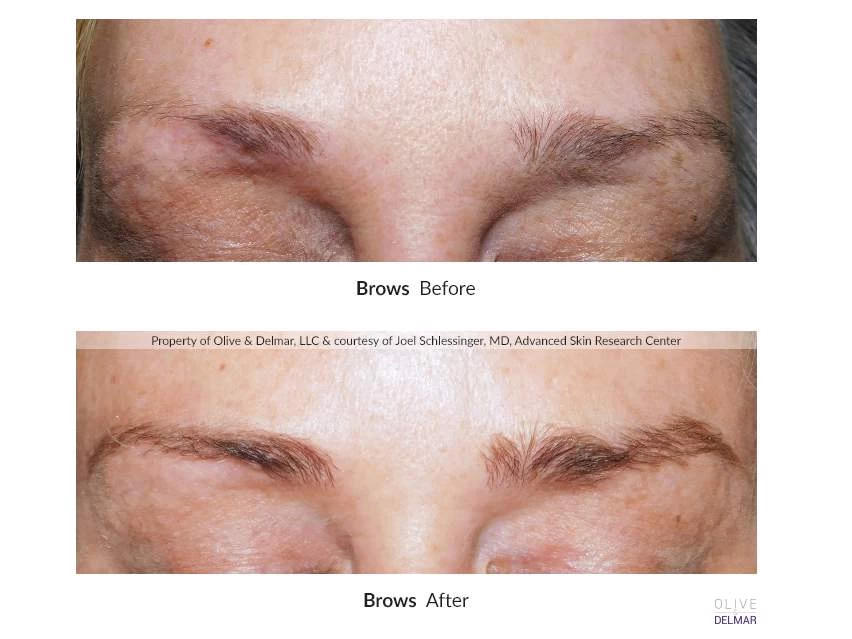 NeuLASH/neuBROW PROFESSIONAL™ By Skin Research Laboratories® Introductory Kit 9 NeuLASH/neuBROW PROFESSIONAL™ By Skin Research Laboratories® Introductory Kit - Image 7