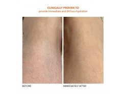 Dr. Dennis Gross Skincare Alpha Beta Exfoliating Body Treatment 23 Dr. Dennis Gross Skincare Alpha Beta Exfoliating Body Treatment -Care Products Store ucknz31g 202102011634508655