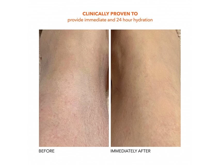 Dr. Dennis Gross Skincare Alpha Beta Exfoliating Body Treatment 13 Dr. Dennis Gross Skincare Alpha Beta Exfoliating Body Treatment - Image 11