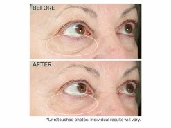 StriVectin Hyperlift Eye Instant Eye Fix 11 StriVectin Hyperlift Eye Instant Eye Fix -Care Products Store ujvjf3o2 202106302124588167