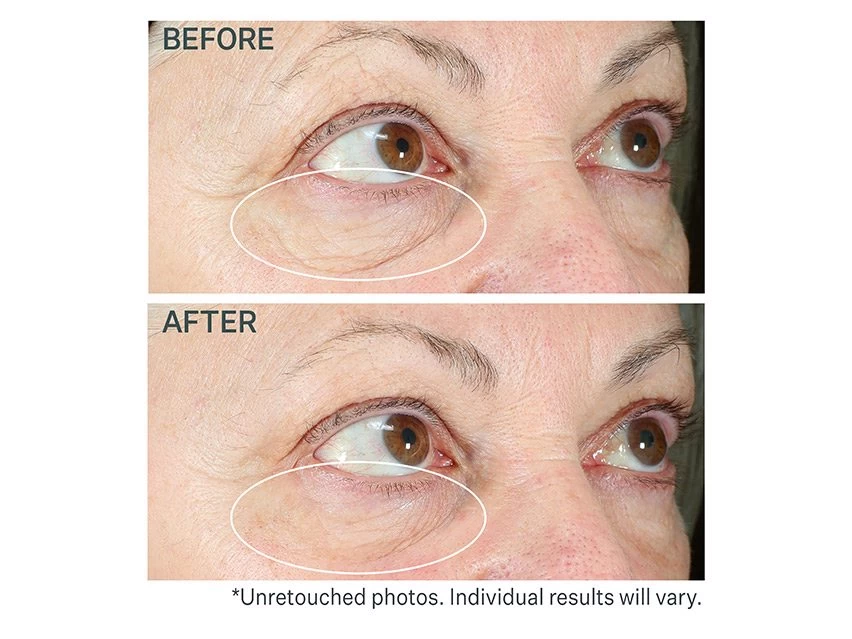 StriVectin Hyperlift Eye Instant Eye Fix 7 StriVectin Hyperlift Eye Instant Eye Fix - Image 5