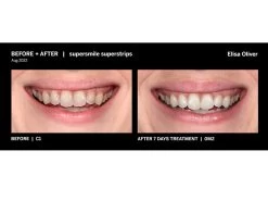 Supersmile Professional Teeth Whitening Superstrips -Care Products Store v2hlvqvv 202211091656325723