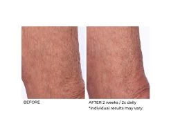 NassifMD® Crepe Inhibitor Triple Action Body Butter 12 NassifMD® Crepe Inhibitor Triple Action Body Butter -Care Products Store weldbg5s 202009221703373178