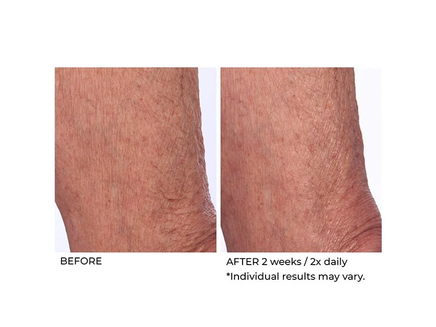 NassifMD® Crepe Inhibitor Triple Action Body Butter 7 NassifMD® Crepe Inhibitor Triple Action Body Butter - Image 5