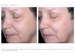 Emepelle Night Cream 21 Emepelle Night Cream -Care Products Store x5kifeuj 202102161744026675