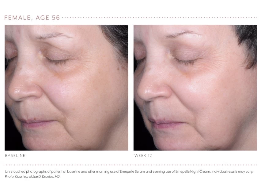 Emepelle Night Cream 12 Emepelle Night Cream - Image 10