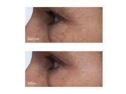 Perricone MD Cold Plasma Plus+ Eye Advanced Eye Cream 9 Perricone MD Cold Plasma Plus+ Eye Advanced Eye Cream -Care Products Store xavjxpcu 202002271626273975