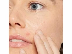 Dermalogica Deep Acne Liquid Patch 18 Dermalogica Deep Acne Liquid Patch -Care Products Store xd3woqzf 202305111902400787