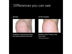 PCA SKIN Body Therapy -Care Products Store xyeeu4od 202205241517485182