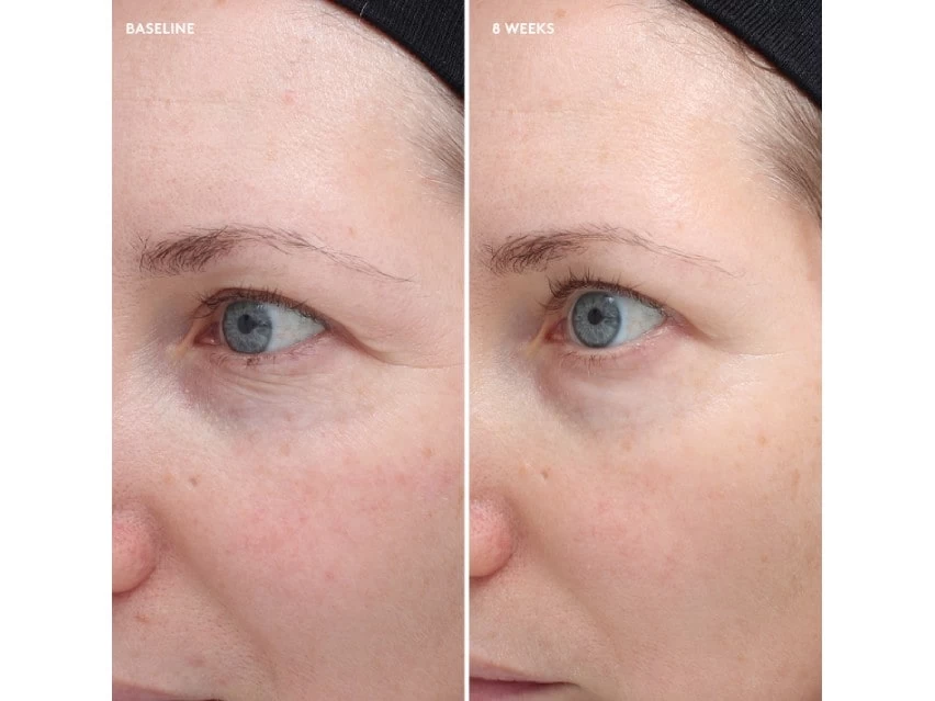 Colorescience Total Eye Firm & Repair Cream 7 Colorescience Total Eye Firm & Repair Cream - Image 5