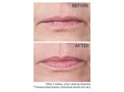 StriVectin Double Fix For Lips Plumping & Vertical Line Treatment 7 StriVectin Double Fix For Lips Plumping & Vertical Line Treatment -Care Products Store yakhsp53 202106302102309072