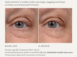 SkinMedica Instant Bright Eye Cream -Care Products Store ynzvv0vi 202002192344529164