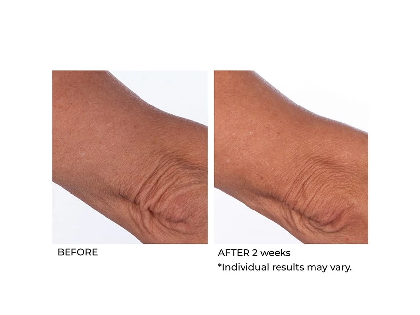 NassifMD® Crepe Inhibitor Triple Action Body Butter 6 NassifMD® Crepe Inhibitor Triple Action Body Butter - Image 4