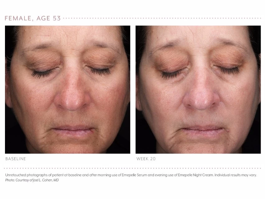 Emepelle Night Cream 9 Emepelle Night Cream - Image 7
