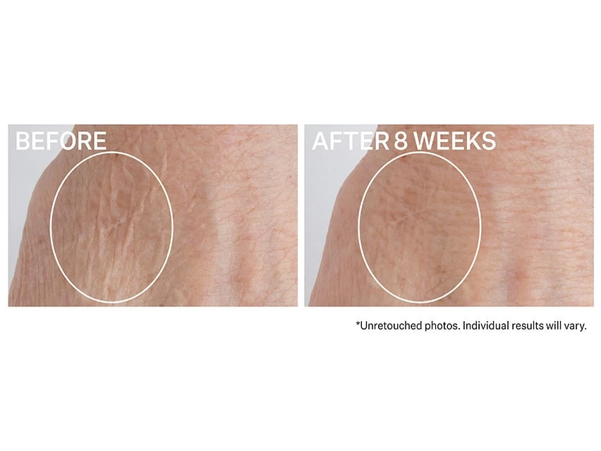 Strivectin Crepe Control Brightening And Firming Hand Cream - Limited Edition 5 Strivectin Crepe Control Brightening And Firming Hand Cream - Limited Edition - Image 3