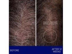 Augustinus Bader The Scalp Treatment -Care Products Store zhmcjayj 202302201954014424