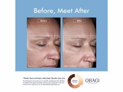 OBAGI Clinical® Dark Spot Disruptor Discoloration Correcting Serum 12 OBAGI Clinical® Dark Spot Disruptor Discoloration Correcting Serum -Care Products Store zjzctciu 202206231540404929