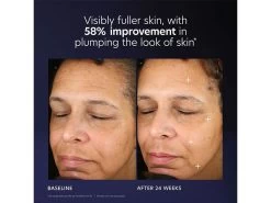 PCA SKIN Pro-Max Age Renewal Advanced Serum -Care Products Store zlm0rnox 202305231702212560