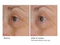 NassifMD® Peri-Orbital Complex Revitalizing Eye Cremè 8 NassifMD® Peri-Orbital Complex Revitalizing Eye Cremè -Care Products Store zm3lnl5p 202009231753220911