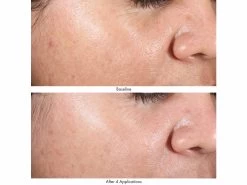 Obagi Medical Revivify Multi-Acid Facial Peel -Care Products Store zqfcyopl 202201272055249376