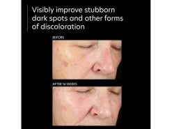 PCA SKIN Pigment Gel Pro -Care Products Store zs5lsilp 202303141600336807