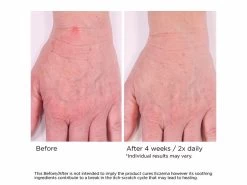 NassifMD® Eczema Soothing Skin Cream 10 NassifMD® Eczema Soothing Skin Cream -Care Products Store zyk35ubu 202103051350466941